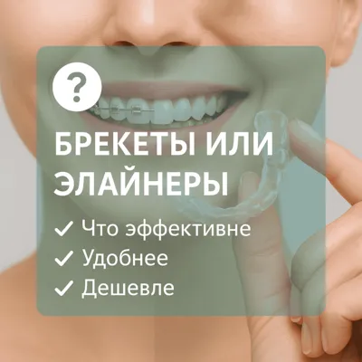 Брекеты или элайнеры: что эффективнее, удобнее и дешевле