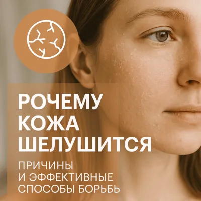 Почему кожа шелушится: причины и эффективные способы борьбы