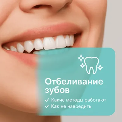 Отбеливание зубов: какие методы работают и как не навредить