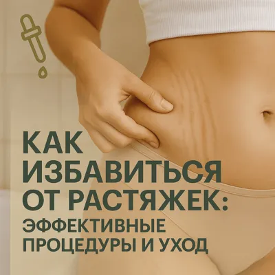 Как избавиться от растяжек: эффективные процедуры и уход