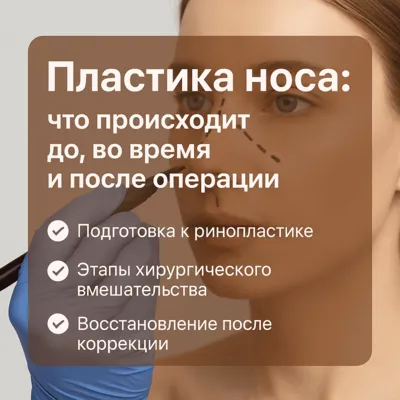 Пластика носа: что происходит до, во время и после операции